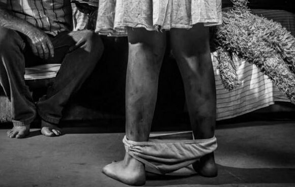 explotacion-sexual Cerca de mil casos de explotación sexual infantil se han presentado este año en Colombia